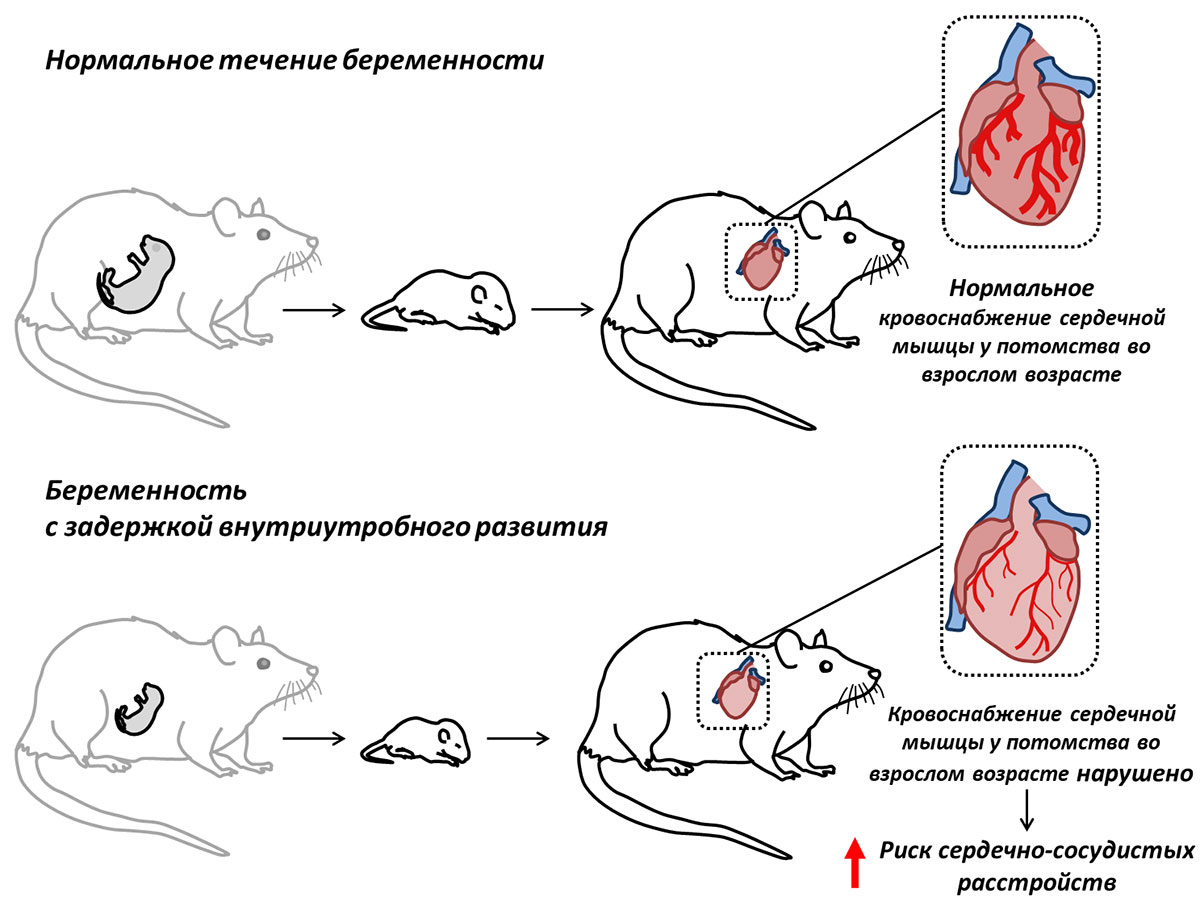 Биологи МГУ: Задержка внутриутробного развития может привести к нарушениям  работы сердца